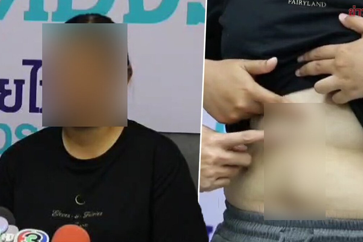 사라부리 담낭수술 뒤 담관 손상, 1년째 치료 중이에요